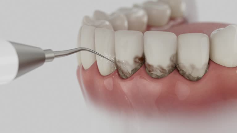 Reliable Emergency Dentist contractor in Parkway, CA by Smile Center Dentistry